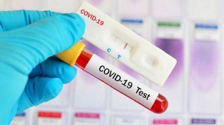 test covid-19 rapid antigen